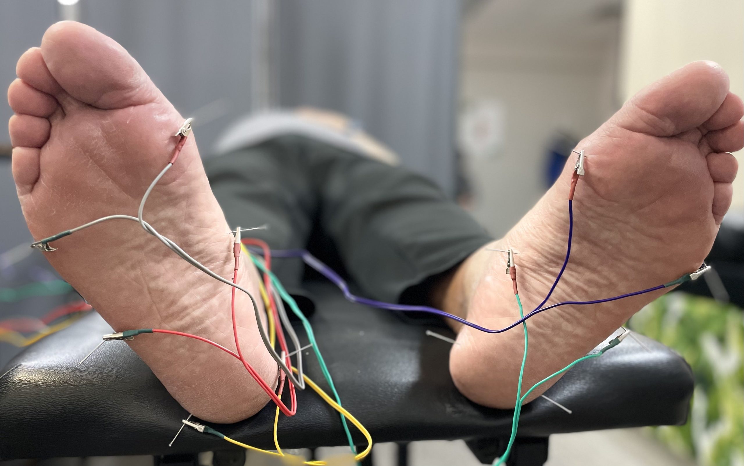 Dry needling in lubbock tx